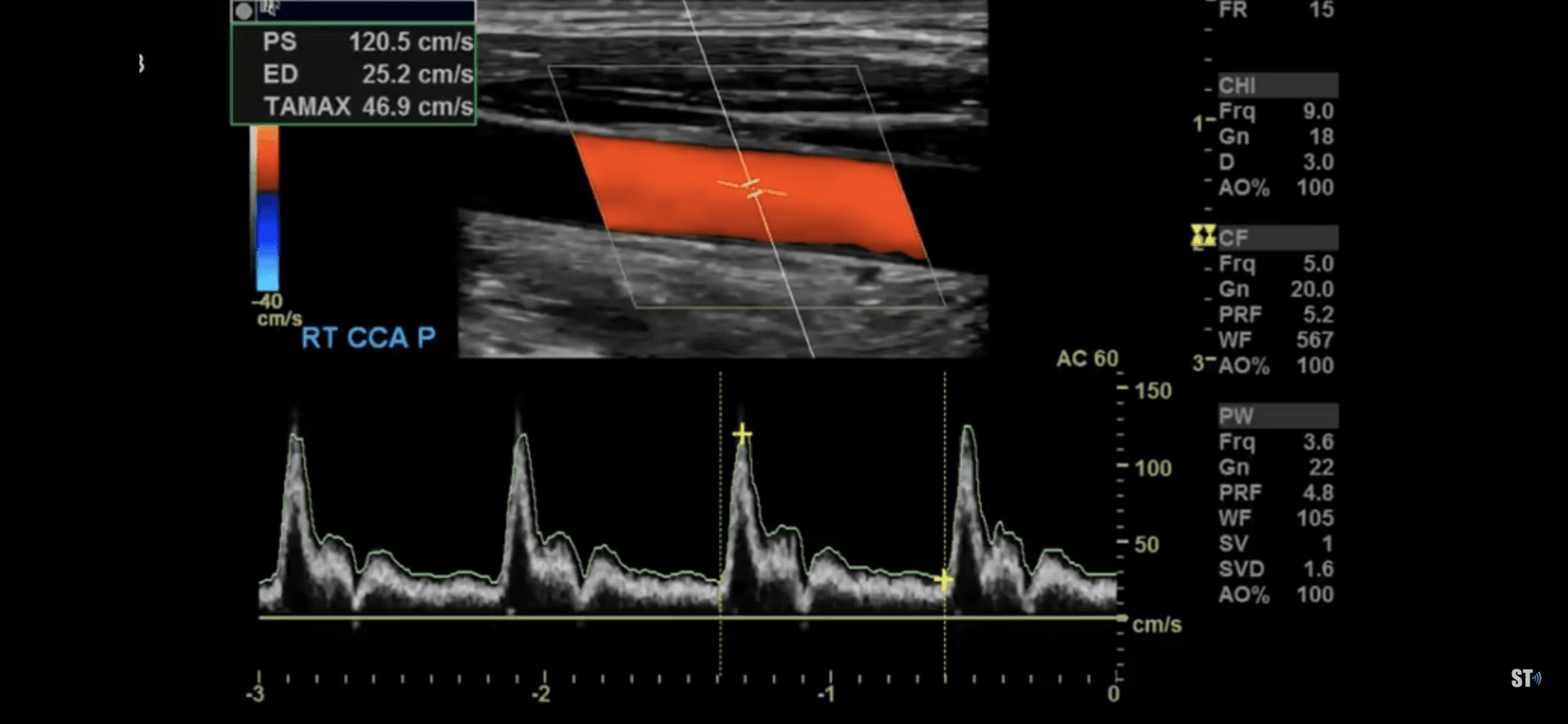 Echokardiographie - Herzultraschall